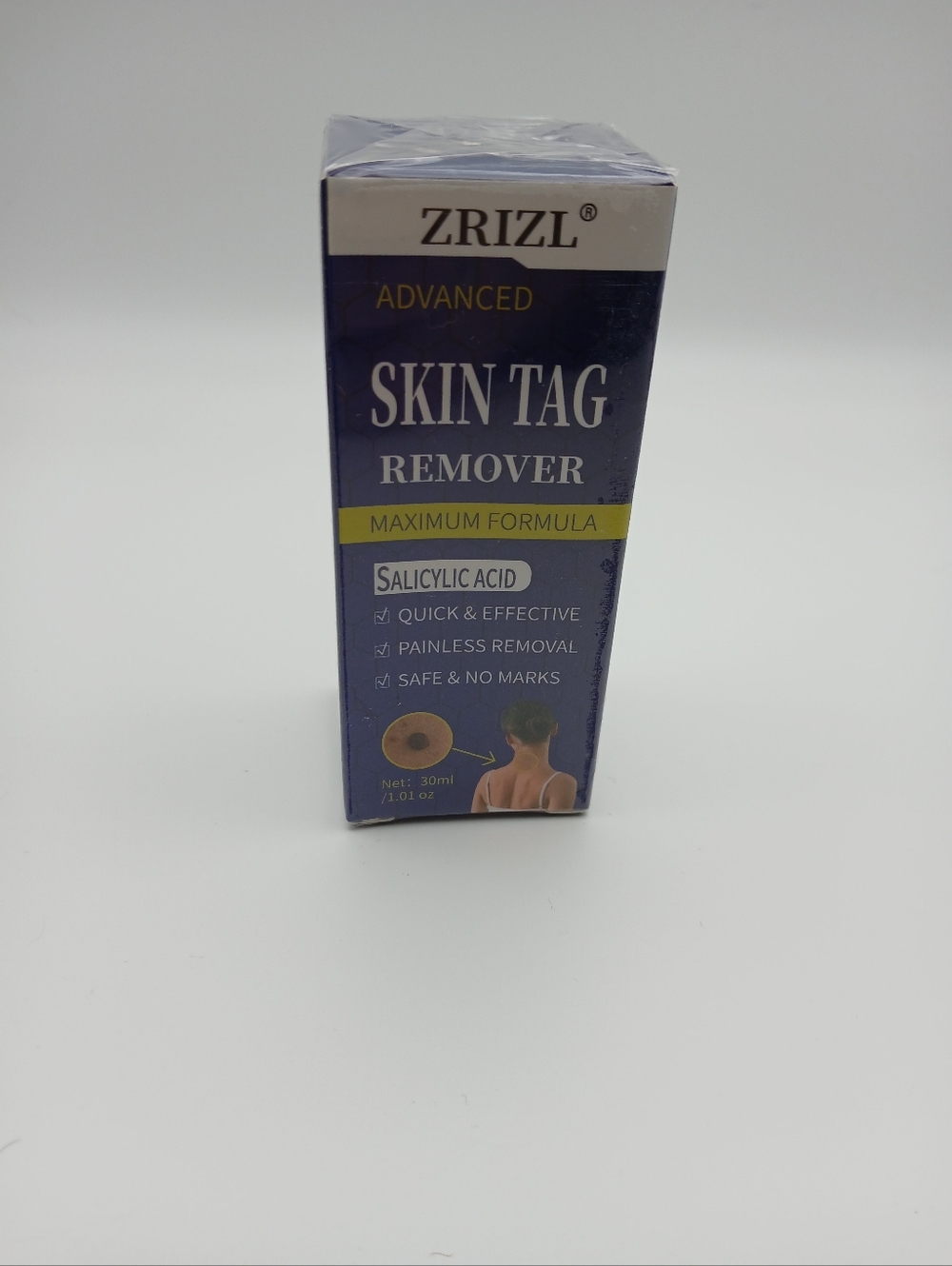 ZRIZL Advanced Skin Tag Remover